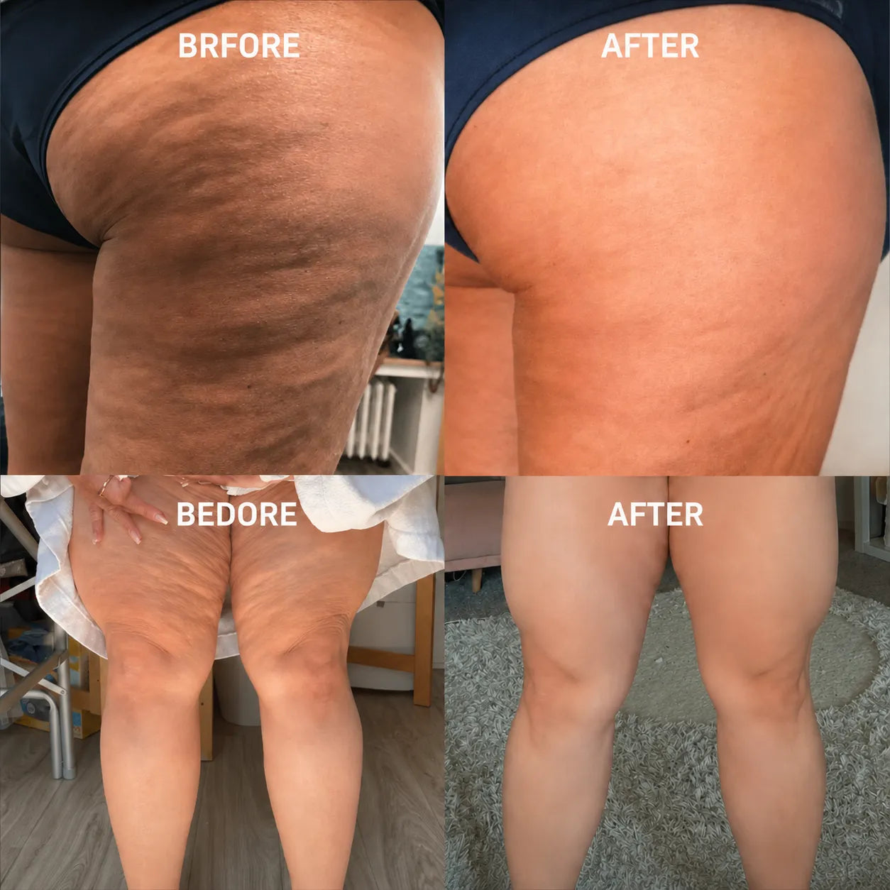 Firmer, Smoother Skin in Less 5 Minutes a Day