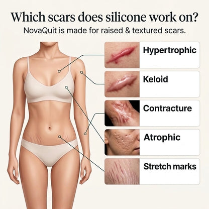 Smooth Your Scars — Just 60 Seconds a Day