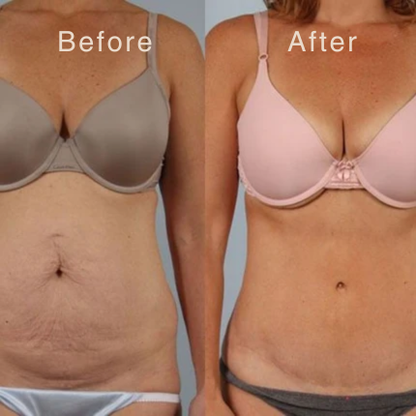 Smooth Your Scars — Just 60 Seconds a Day