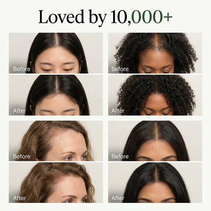 Korean Scalp Restore Bar